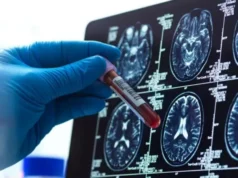 4 avances esperanzadores para la enfermedad de Alzheimer este año